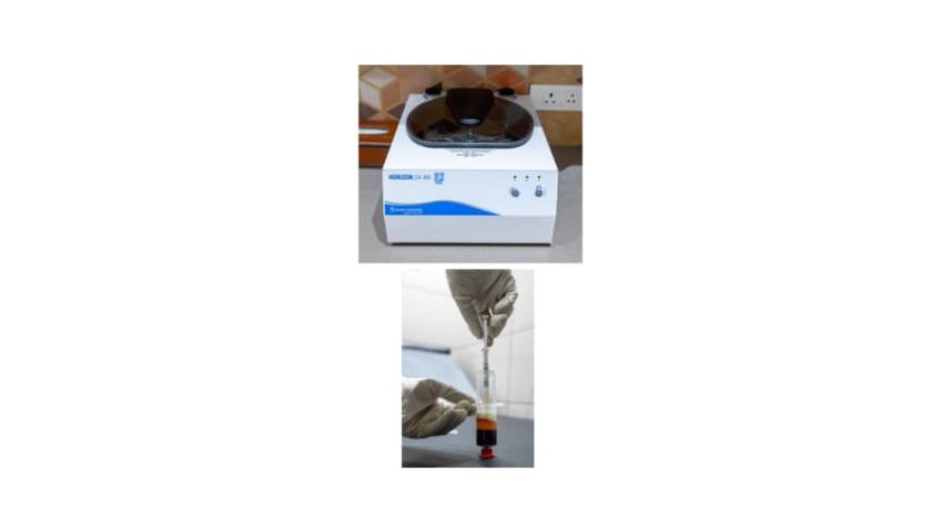 IPRF Treatment 