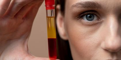PRP - Platelet Rich Plasma Treatment