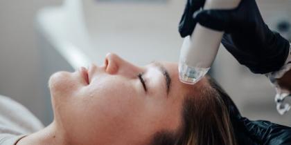 Microneedling (MNRF)