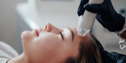 Microneedling (MNRF)