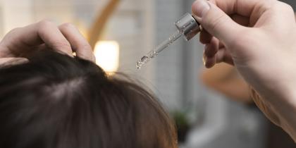 Hair Exosome Therapy
