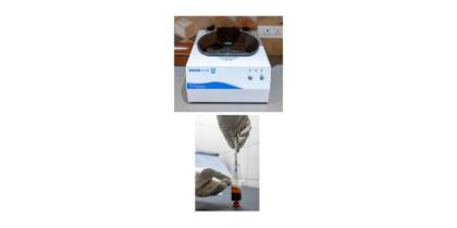 IPRF Treatment 